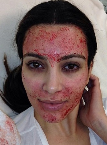 Kim Kardashian, sangre Kim Kardashian, sangre